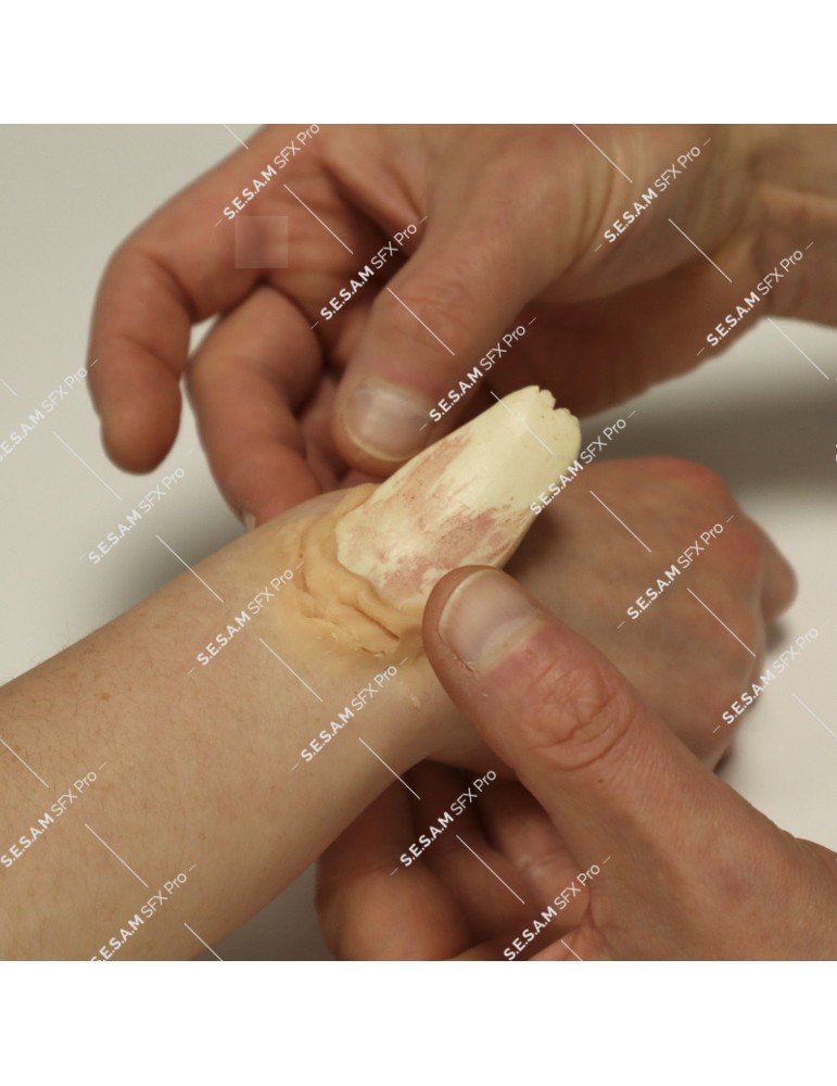 os en résine pour simuler une fracture