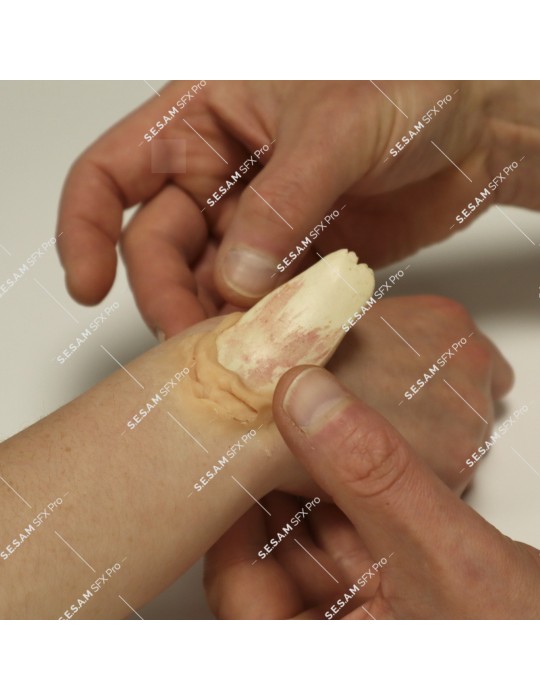 os en résine pour simuler une fracture