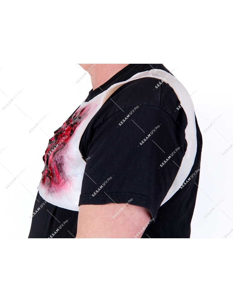 Brulure thermique thorax