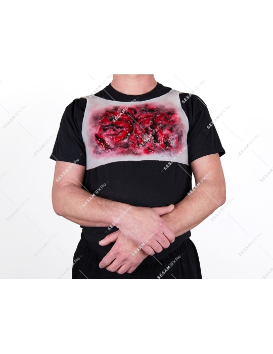 Brulure thermique thorax