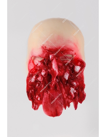 Délabrement facial