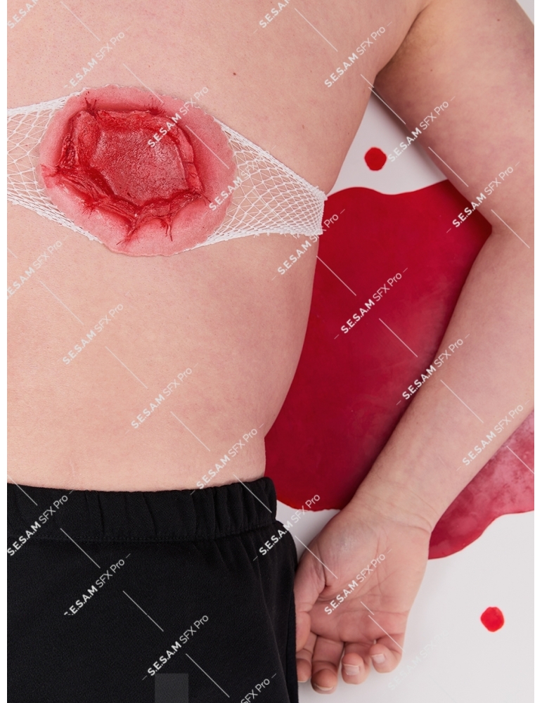 Plaie par balle grande sortie