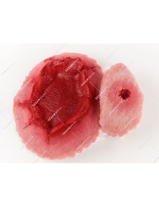 Plaie par balle grande sortie