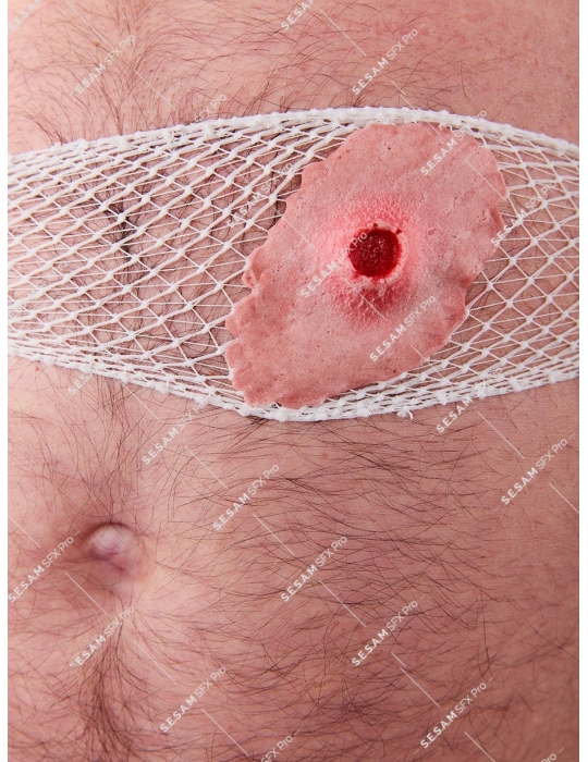 Plaie par balle grande sortie