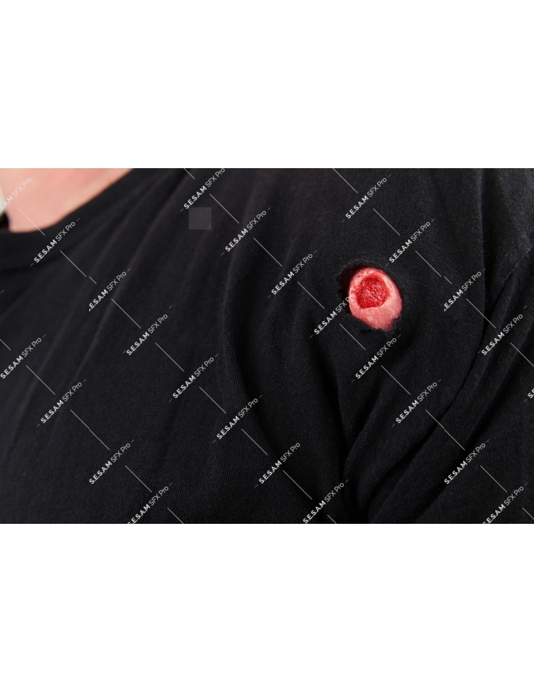 Plaie par balle petite sortie