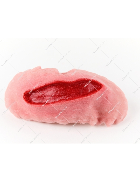 Plaie filet hémorragique