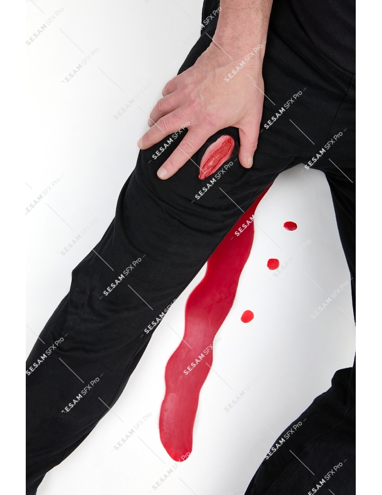 Plaie filet hémorragique