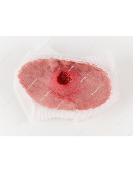 Plaie par balle 1 entrée