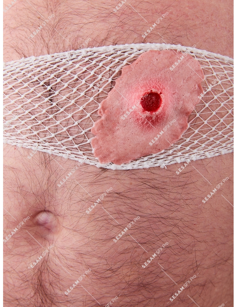 Plaie par balle 1 entrée