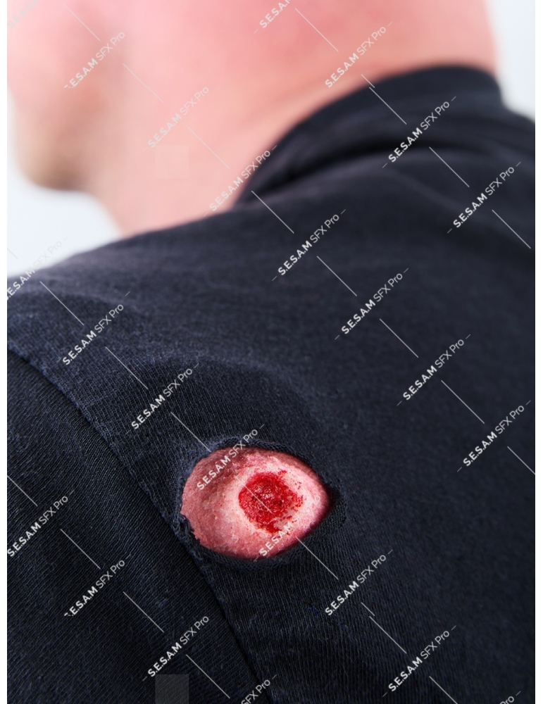 Plaie par balle 1 entrée