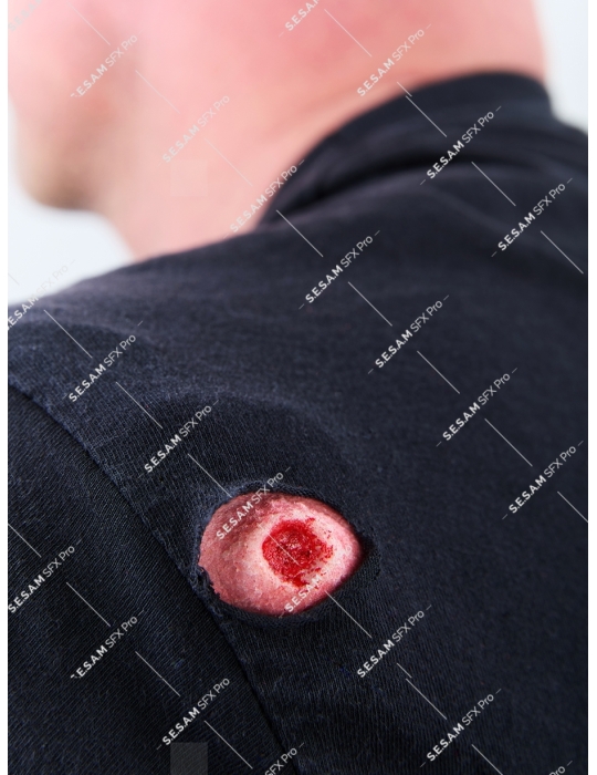 Plaie par balle 1 entrée