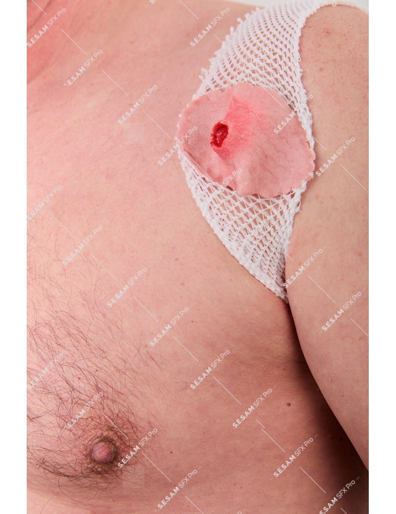 Plaie par balle 1 entrée