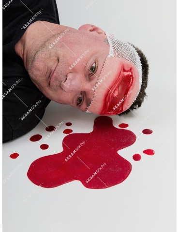 scalp frontal 2