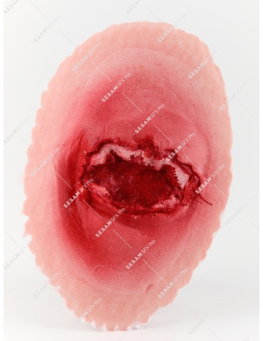 Plaie à l'oeil